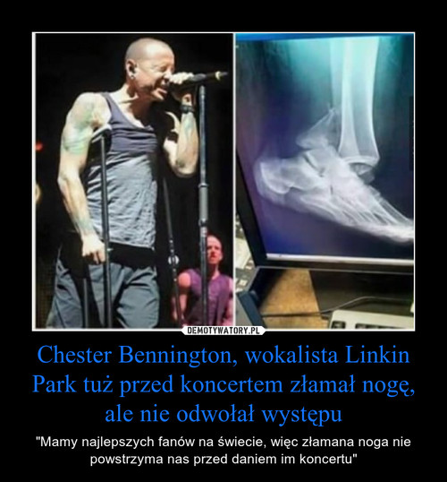 Chester Bennington, wokalista Linkin Park tuż przed koncertem złamał nogę, ale nie odwołał występu