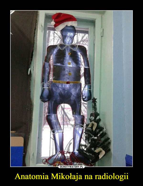 Anatomia Mikołaja na radiologii