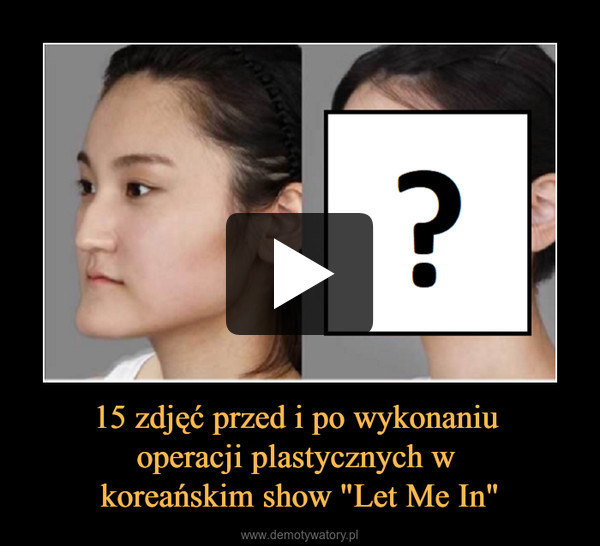 15 zdjęć przed i po wykonaniu operacji plastycznych w koreańskim show "Let Me In" –  