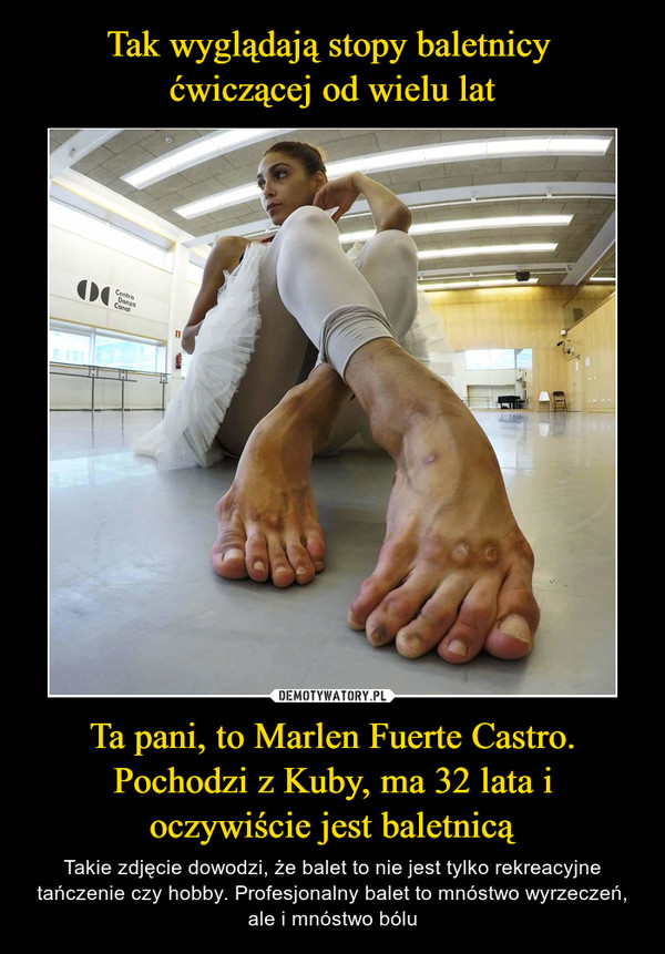 Ta pani, to Marlen Fuerte Castro. Pochodzi z Kuby, ma 32 lata i oczywiście jest baletnicą – Takie zdjęcie dowodzi, że balet to nie jest tylko rekreacyjne tańczenie czy hobby. Profesjonalny balet to mnóstwo wyrzeczeń, ale i mnóstwo bólu 